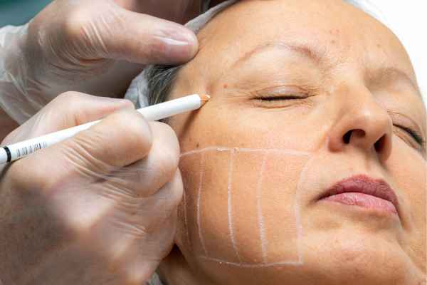 CryoPen: 5 Skin Concerns It May Be Used to Treat 4 What should you ask before having CryoPen treatment Portland Bill?